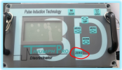 Calibration.png